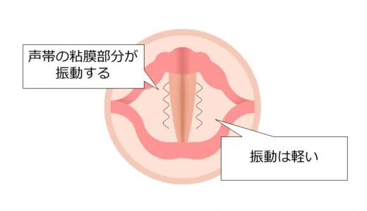 裏声の出し方を練習音源付きで解説。高音を鍛えて音域を広げよう